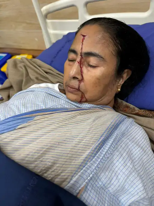 Mamata Banerjee Injured