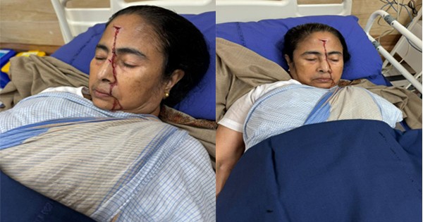 Mamata Banerjee Injured